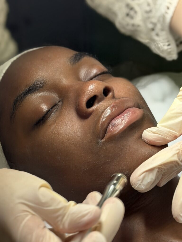 Microdermabrasion facial skin resurfacing treatment at Li's Spa in Redmond, WA